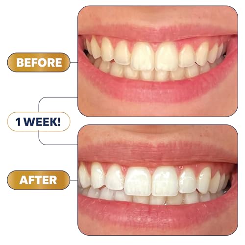 Lumineux Teeth Whitening Strips Kit - 9 Treatments - Peroxide Free - Enamel Safe for Whiter Teeth - Whitening Without The Sensitivity - Dentist Formulated - Sensitivity Free