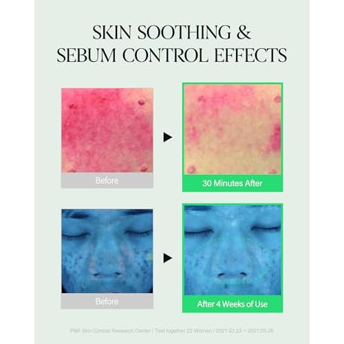 About Me SOOP Calming Aqua Cream ? Korean 77.7% Jeju Cypress Water 100 Hour Moisture Cream for Sensitive Acne Skin ? Daily Jelly Texture with Niacinamide ? Korean Skin Care ? 2.87oz, 85ml