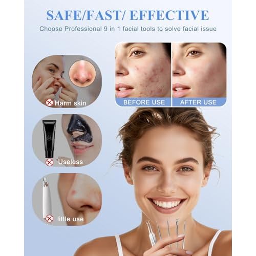5PCS Blackhead Remover Pimple Popper Tool Kit, Professional Stainless Pimple Acne Blemish Removal Tools Kit for Face (Silver)
