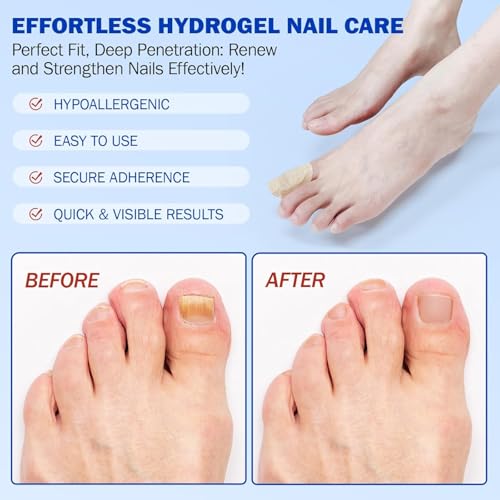 Fungal Nail Patches, Nail patches for toenails, Overnight Toe Nails Treatments for Damaged Foot Nails Repair and Care, Safe for Sensitive Skin, Easy to Apply (2)