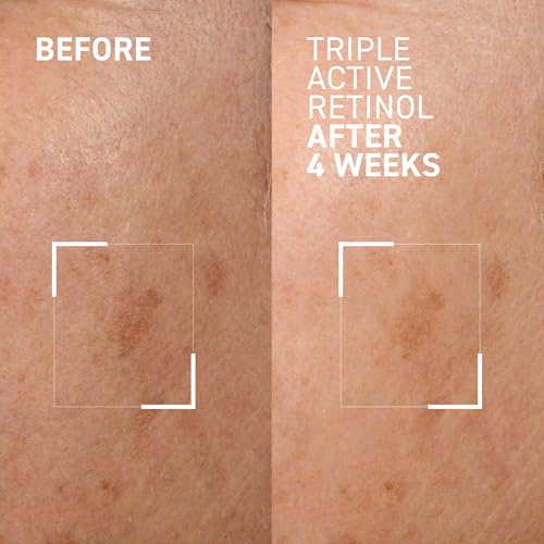 Dr. Brandt Bright This Way Triple Active Retinol - 1 oz, Pack of 2 - Gentle Overnight Renewal Cream - Reduces Wrinkles & Discoloration, Illuminates & Hydrates