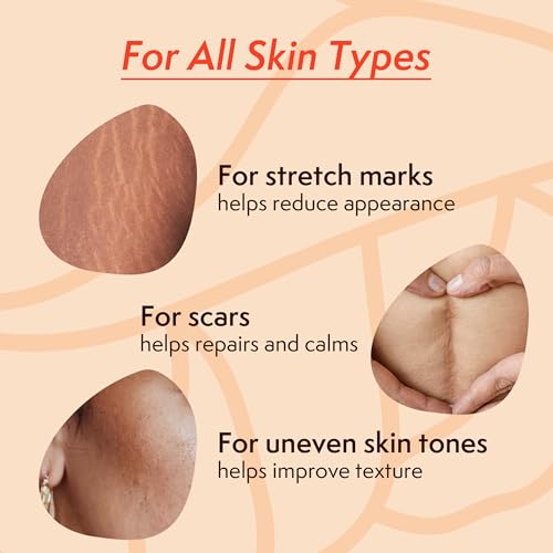 Nature Spell Stretch Mark Oil For Women, Vegan Body Oil for Stretch Marks, Scars & Uneven Skin Tone, 3.38 Fl Oz