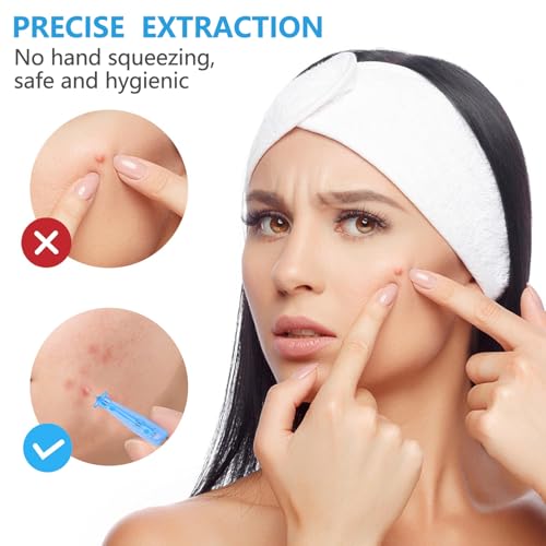 Sterile Needles for Pimples, 50 Pcs Disposable Sterile Pimple Needle and 72 Dots Acne Stickers, Pimple Popper Needle for Clear Skin, Acne Needles Tool for Milia Remover