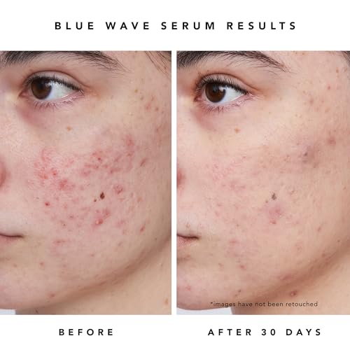 HERBIVORE Blue Besties Duo ? 2-Step Treatment for Acne-Prone Skin, Aquarius Cleanser (50 mL) & Blue Wave Serum (10 mL), Plant-Based, Vegan, Cruelty-Free