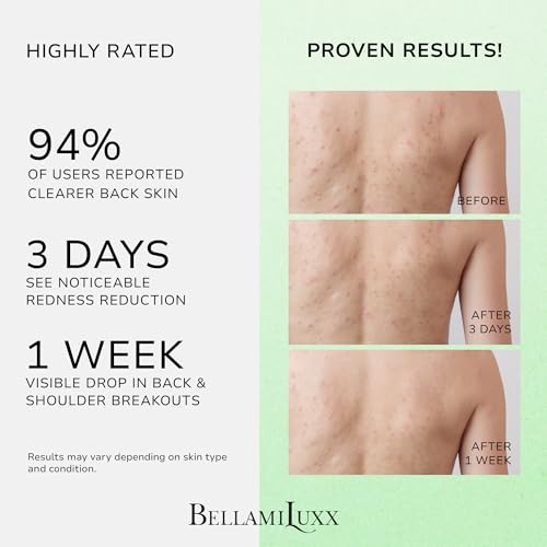 Back & Body Acne Spray Treatment: 2% Salicylic Acid & Tea Tree Oil Bacne Spray for Clear, Soothe & Moisturize - Effective for Men, Women, Teens with Back, Chest, Shoulder, Arm Acne