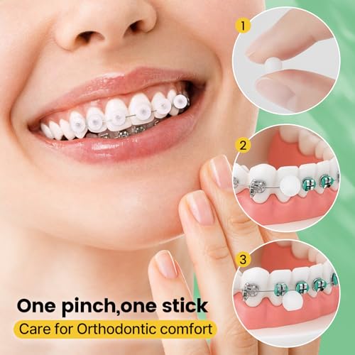 Orthodontic Wax for Braces Wax 120 Individual Hygienic Packaging Dental Wax Dots Mint