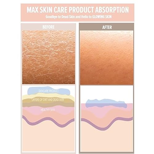 SAERO Korean Exfoliating Mitt for Body ? Deep Scrub Glove for Dead Skin, Spray Tan Removal, Ingrown Hairs & KP ? Korean Spa-Style Viscose Peeling Towel for Shower or Bath ? 1 Count