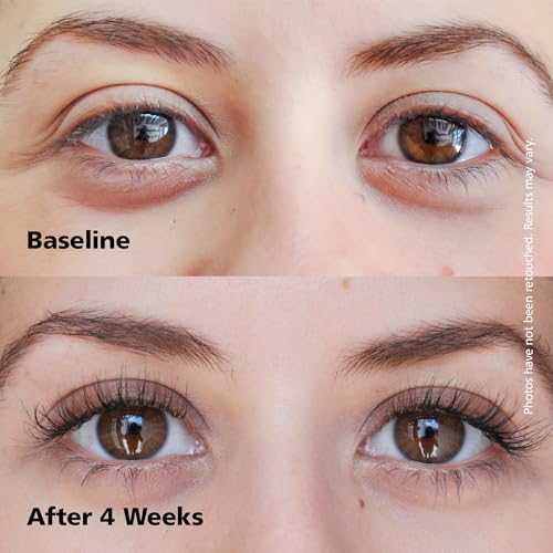 DABALASH Professional Eyelash & Eyebrow Growth Serum with Castor Oil ? Promotes the Appearance of Naturally Longer, Fuller, Thicker & Stronger Lash + Brow Hair ? 0.18 oz
