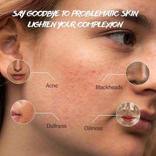 Turmeric Exfoliating Face Wash Vitamin C Facial Cleanser Microdermabrasion Exfoliator Face Scrub Foaming Cleanser Removing Blackhead Acne Moisturizing Soft Natural Skin Care for Women Men