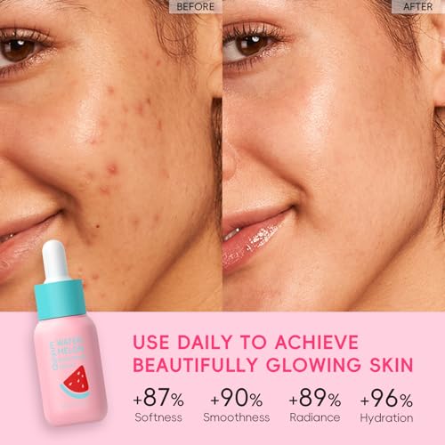 Niacinamide Serum for Face, Skin Care with Watermelon Extract & Hyaluronic Acid, Vitamin C, Hydrating, Glow, Anti-Aging, for Uneven Skin Tone, for Teens Girls Women Gifts, 1 Fl. Oz