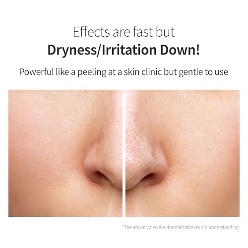 Benton Glycolic Acid 7% Exfoliating Toner with Niacinamide - Gentle AHA Toner for Brighter Skin & Even Tone - Balances Oil & Moisture - Hydrating, Cruelty-Free Korean Skin Care