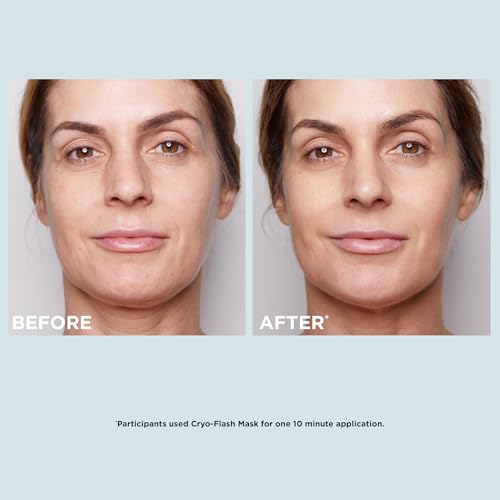 CLARINS Cryo-Flash Face Mask | Visible Lift Effect in 10 Minutes* | Visibly Minimizes Pores | Boosts Radiance | Pro Like Results | All Skin Types