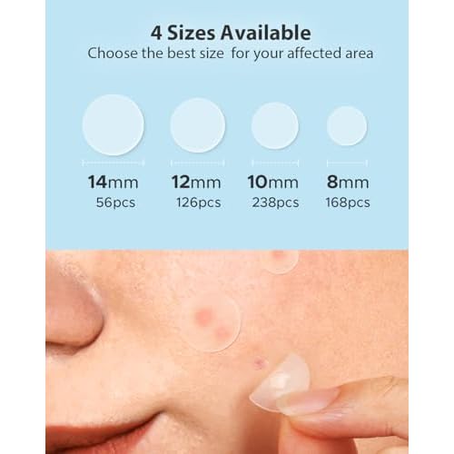 LitBear Acne Pimple Patches- Day and Night 4 Sizes 588 Dots Thin & Thick Hydrocolloid Patches with Witch Hazel, Tea Tree & Calendula Oil, Extra Adhesion for Face Zit Patch Dots