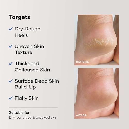 Cureskin Foot Care Cream for Cracked Heels | Repairs, Softens, and Exfoliates | Foot Cream for Women and Men, 50 g (Pack of 1)