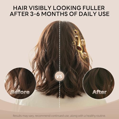 ALFHEIM Coffee+ Thickening Conditioner for Fine, Thin & Weak Hair with Caffeine, Biotin & Arabica Coffee Oil, Strengthening, Moisturizing & Volumizing Formula, Paraben-Free, Sulfate-Free, 33.8 oz 1L