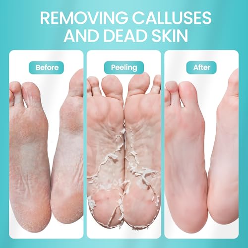 Foot Peeling Mask for Dead Skin Remover & Deep Moisturize | 2 Pairs | Dermatologically Tested - Foot Peel Mask for Dry Cracked Feet - Foot Mask make Soft Baby Feet for Men & Women | Aloe Vera