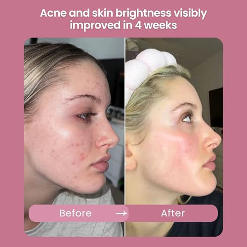Glow Serum & Infinite Aura Moisturizer Bundle - THD Vitamin C Face Serum + Ceramide & Hyaluronic Barrier Repair Cream with Copper Peptide, 1 fl oz + 1.7 fl oz