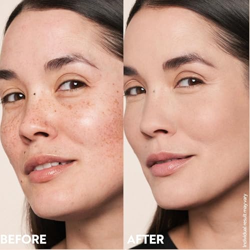 M. Asam Magic Finish Make-Up Mousse (1.01 Fl Oz) ? 4in1 Primer, Foundation, Concealer & Powder With Buildable Coverage, Hides Redness And Dark Spots, Vegan, For Light To Medium Skin Tones