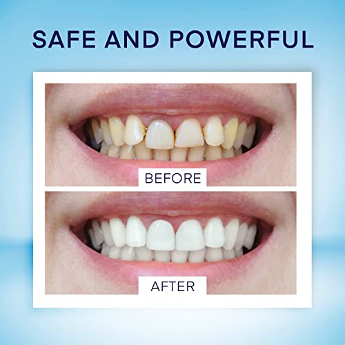Teeth Whitening Pen (4 Pens) for Teeth Whitening, 40+ Uses, Effective, Painless, No Sensitivity, Travel-Friendly, Beautiful White Smile, Mint Flavor