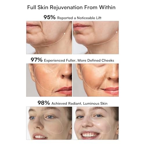 INIA 3-in-1 Red Light Therapy for Face and Neck Beauty Device for Puffiness & Skin Firming Skincare Tool (White)