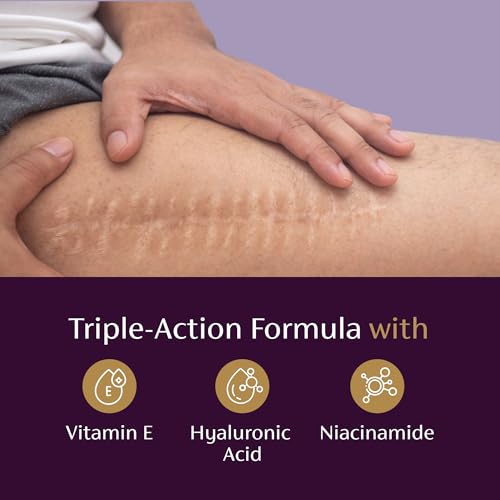 Mederma Scar Serum ? Triple-Action Formula with Vitamin E, Hyaluronic Acid & Niacinamide ? Clinically Shown to Reduce Old Scars, 1 Fl. Oz.