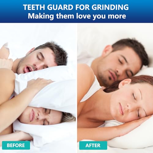 Mouth Guard for Grinding Teeth at Night, Night Guards for Teeth Grinding, Mouthguards for Grinding of Teeth, Mouth Guard for Clenching Teeth at Night with 12 Cleaning Tablets