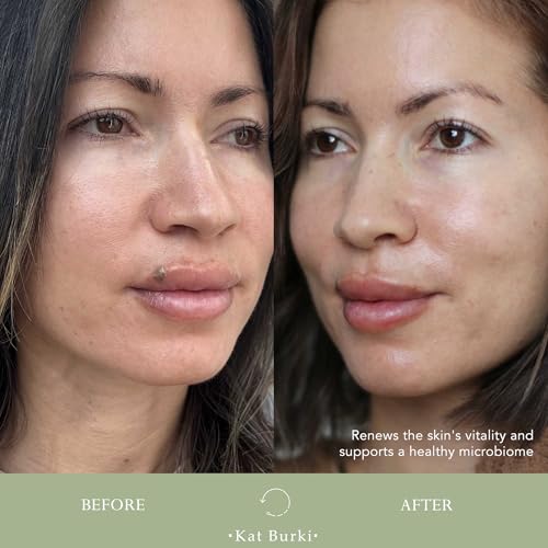 Kat Burki pH+ Enzyme Essence Face Serum, Balancing and Smoothing with Pumpkin and Papaya Enzymes, Turmeric, Licorice Root, and KB5 Complex, 3.4 Fl Oz