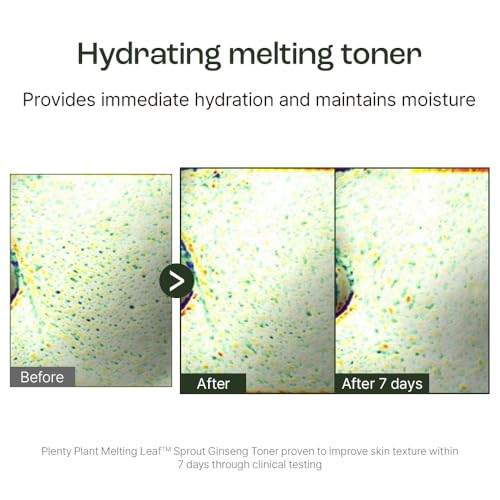 Plentyplant Melting Sprout Ginseng Face Toner, Beauty of Ginseng Essence Water Hydrating Face Toner for Oily and Aging Skin, Korean Moisturizing Skin Care for Men and Women 150ml, 5 fl.oz