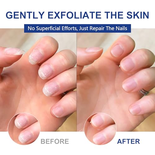 Nails Spray Fast-Drying Nail Care Moisturizer with No Odor Formula for Men & Women, Safe Mild Ingredients, 30ml/1fl oz