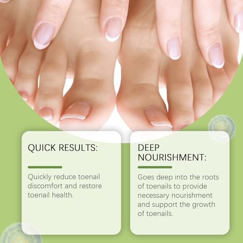 Nail Growth Serum Nail Care - Nail Repair for Damaged Toenails and Fingernails, Toenails Renewal Liquid for Thick, Damaged, Yellow, Ingrown Nails (30ml)