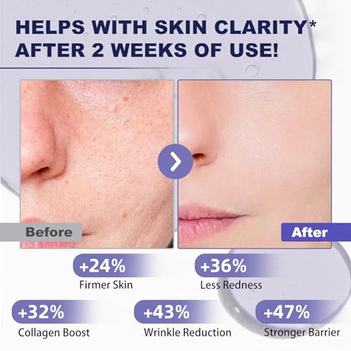 Bakuchiol Retinol Alternative Serum 50ML - 40,000 ppm All Plant-Based Formula Anti-Aging Face & Eye Care Plumping Serum for Sensitive Skin - Natural Firming & Elasticity