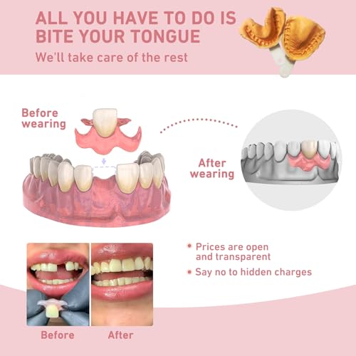 Custom Partial Dentures ? Personalized Removable Denture Set for Missing Teeth | 1?6 Tooth Replacement with Storage Case | Natural Look & Comfortable Fit (2 Teeth)