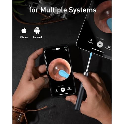 Ear Wax Removal, Ear Cleaner with Camera and Light, Ear Wax Removal Kit, Ear Wax Removal Tool Camera with 1080P, Ear Cleaning Kit with Spoons, Ear Camera for iOS & Android