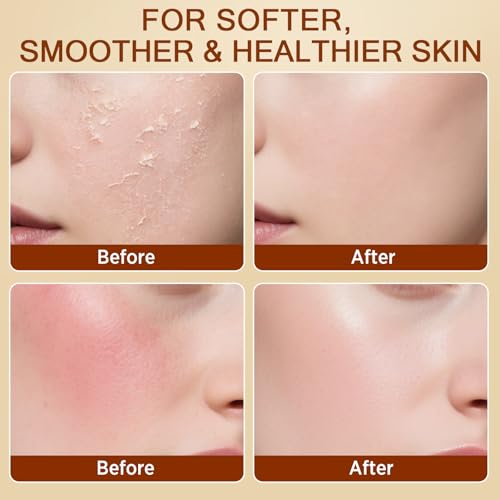 Tallow and Honey Balm for Face, Beef Tallow for Skin, Grass-Fed Beef Tallow & Raw Wild Honey, Body & Face Moisturizer