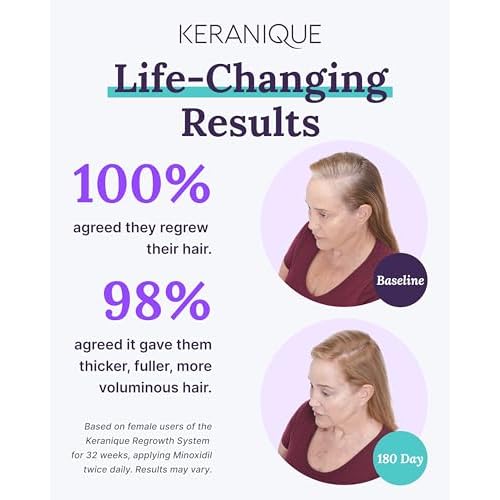 Keranique Hair Growth Treatment for Women - Minoxidil Regrowth System with Hydrating Shampoo, Conditioner, Volumizing Spray, and Hair Loss Treatment