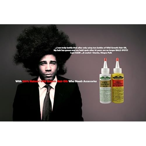 Wild Growth Hair Oil - 4oz/118.291ml by Wild Growth