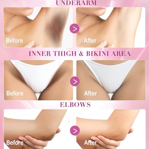 Skin Lightening Cream, Dark Spots Remover for Body Even Toning, Effectively Whitening Women Intimate Areas, Bikini Line, Underarms, Knees, Elbows, Renew Complexion and Replenish Skin Barrier