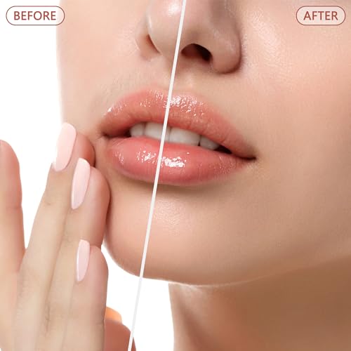 Facial Hair Remover for Women - as Seen on TV Painless Face Shaver - Electric Hair Removal Device for Face Lips Peach Fuzz with Light (Rose Gold)