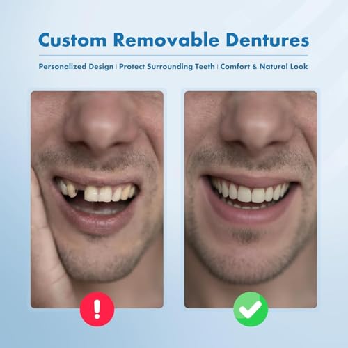 Partial Dentures - Custom Removable Personalized Tooth Replacement Set for Missing Teeth & Gap (2 Teeth)
