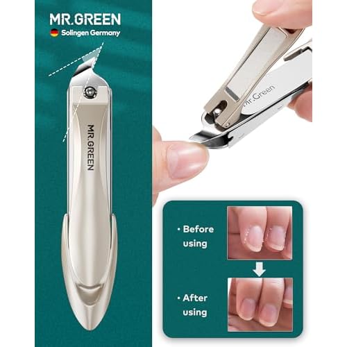 MR.GREEN Nail Clippers, Upgraded Anti-Splash Nail Clipper Set with Nail File and Tweezers & Catcher, Professional Practical Manicure Nail Care Kit with Exquisite Leather Case for Men & Women