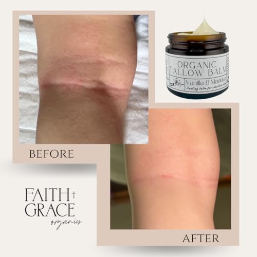 Faith and Grace Organics, Organic Tallow Balm, Vanilla and Manuka Honey, All-purpose Moisturizer, Safe for sensitive skin, Healing balm, 2 oz glass jar