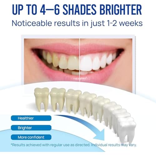 VieBeauti Teeth Whitening Pen (3 Pcs), 30+ Uses, Effective, Painless, No Sensitivity, Travel-Friendly, Easy to Use, Beautiful White Smile, Mint Flavor