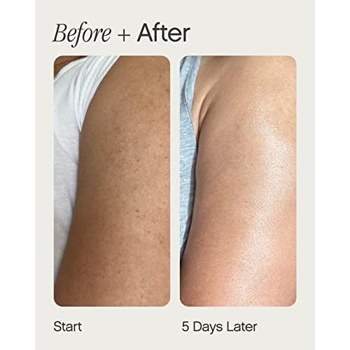 Topicals Slather Exfoliating Body Serum - With Retinol, Squalane, Urea and AHAs for Bumpy, Rough or Textured Skin - AHA Exfoliating Serum for Body (5 Fl Oz)