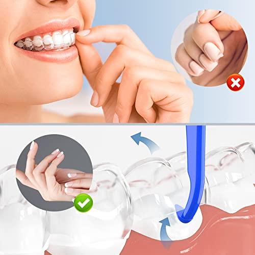 ARGOMAX - Aligner Removal Tool, 100 Retainer Remover Tool, Invisible Braces Removal Tools, Suitable for Removing Braces, Trays, Retainers, Dentures and Aligners(Blue).