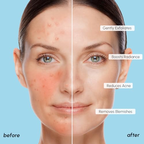 MAREE Glycolic Acid Pads - Toner Pads for Face Cleansing - Exfoliating Pad with Tea Tree Oil, Salicylic Acid & Vitamins E, B3, B5 - Acne Clearing, Skin Pore Resurfacing & Radiance Device - 50 Count