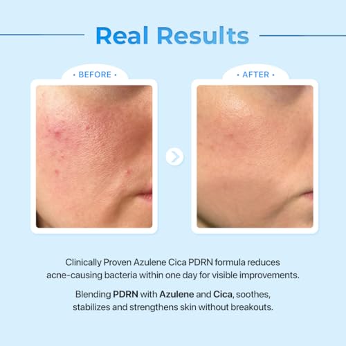 Le Nubele Azulene Cica Hyaluronic PDRN Capsule Standard Ampoule 02, Salmon DNA PDRN 3,000ppm, Peptide, Collagen Booster, Skin Rejuvenation, Hydrating, Acne Skin, Korean Skin Care 30ml/1.01 fl.oz.