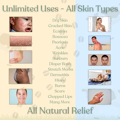 Beef Tallow for Skin - NAKED TALLOW BALM I 1 Ingredient - 100% Grass Fed Beef Tallow | Whole Body & Face | Whipped & UNSCENTED for Sensititve Dry Skin, Babies, Eczema, Psoriasis, Rosacea (9oz)