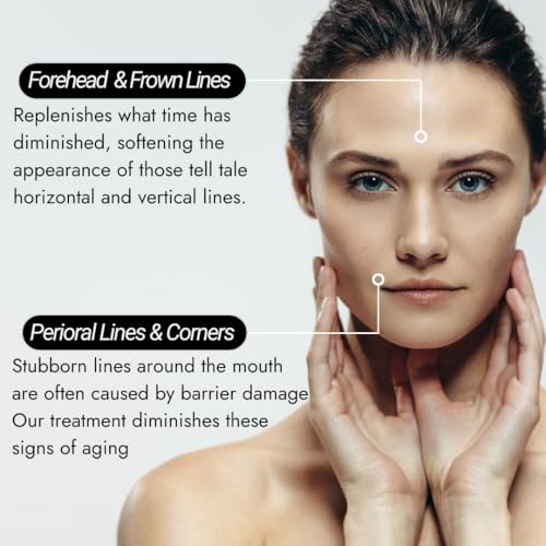 CDERMA Anti-Aging Face Cream Fights Wrinkles, Firming & Hydrating Moisturizer with Dual Hylauronic Acid For Dry Skin, Sensitive Skin, Aging Skin Made in France, 1.76 fl oz