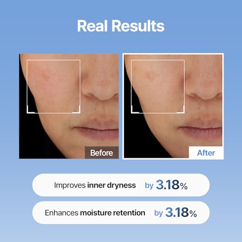 Meditherapy Hyaluronic Acid Serum XXL 150ml (5.07 fl.oz.) ? Ultra Hydrating Serum for Glowing Skin, Face Moisturizer, Non-Sticky, Anti-Aging & Wrinkle Care, Korean Skin Care