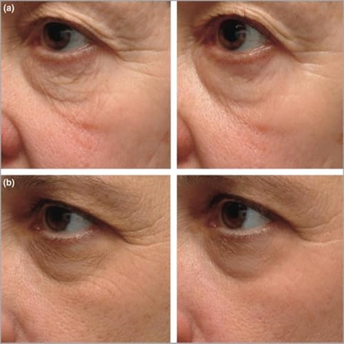 Instant Firming Eye Serum, 15ml(0.49 oz) ? Targets Under-Eye Bags? Wrinkles, Dark Circles & Fine Lines | Anti-Aging Formula | For Daily Use (Fragrance Free)